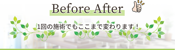 Before After