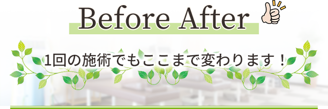 Before After